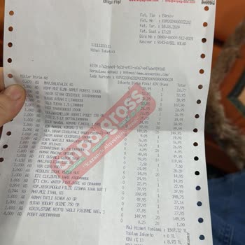 Anpa Gross Market Pendik Şubede Düştüm Ve Ayağım Alçıya Alındı