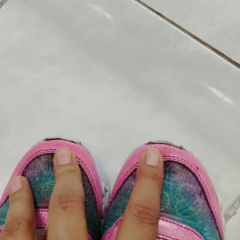 Skechers Ayakkabı Mağduriyeti, Kullanıcı Hatası Olmayan Ayakkabı