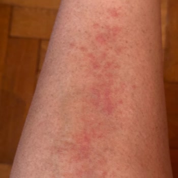 Eda Taşpınar Bomba Güneş Yağı