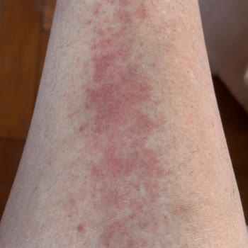 Eda Taşpınar Bomba Güneş Yağı