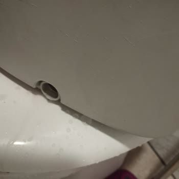 Parex Wondero Tıpa Şikayet