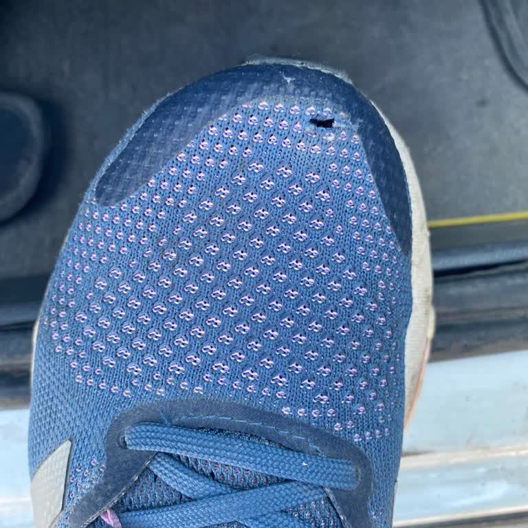4 Aylık Adidas Ayakkabım Yırtıldı
