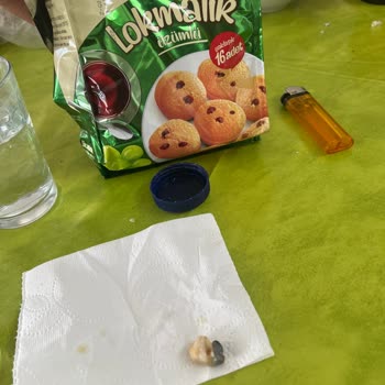 Ülker Lokmalık Kekten İnsan Dişi Çıktı!