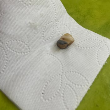 Ülker Lokmalık Kekten İnsan Dişi Çıktı!