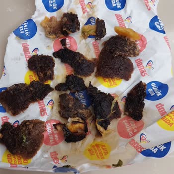 Donas Gelen Siparişin Yanık Olması