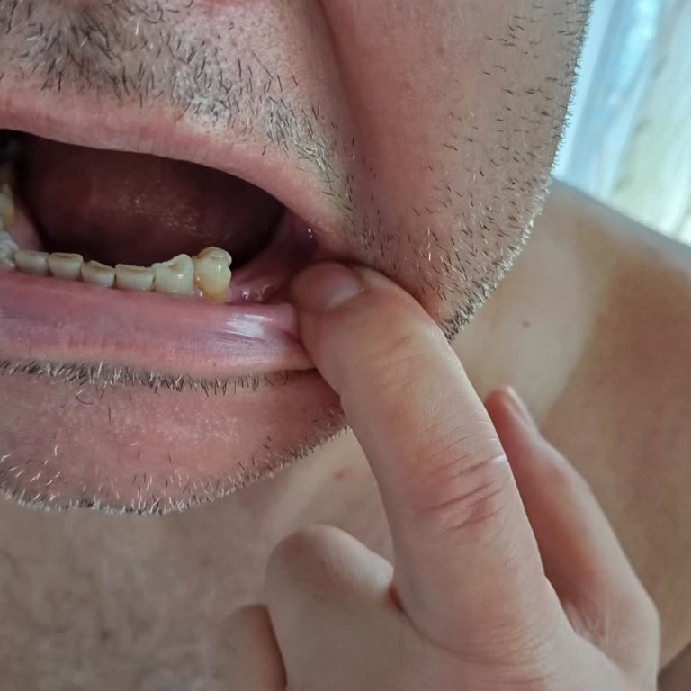 Sağlık Bakanlığı Ağzımızda Diş Kalmadı Sayın Koca