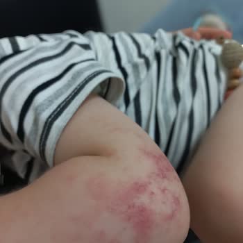 Bakırçay Üniversitesi Çiğli Eğitim ve Araştırma Hastanesi Bakırçay Çiğli Eğitim Ve Araştırma Devlet Hastanesi