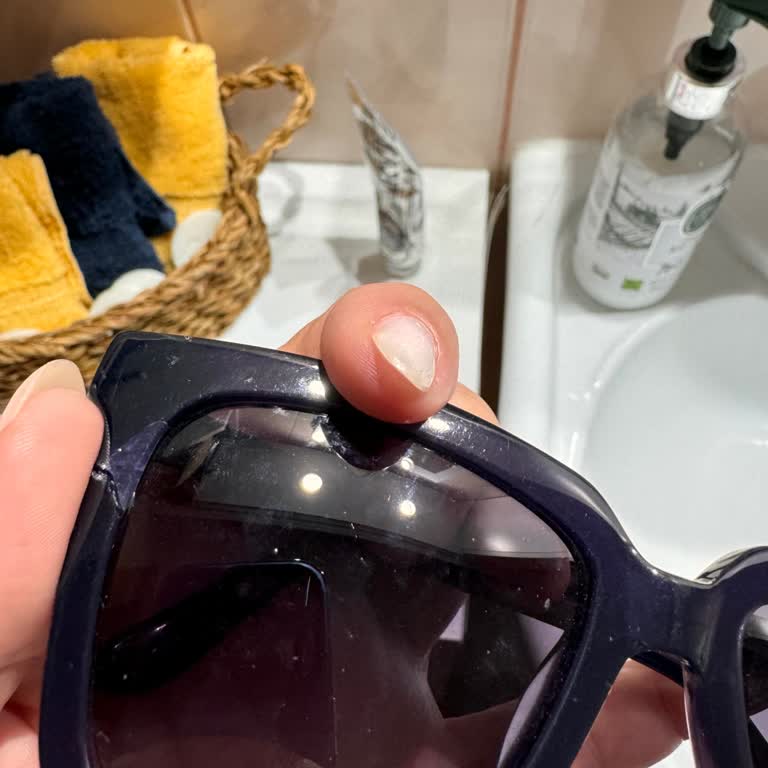 Hawk Eyewear Hawk Marka Gözlük Satış Sonrası Hizmet Eksikliği