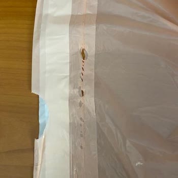 Koroplast Çöp Torbası Sorunu