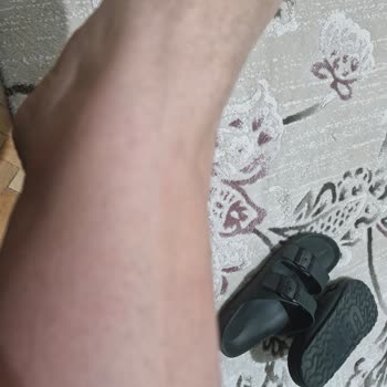 Sinoz No16 Alerji Yaptı