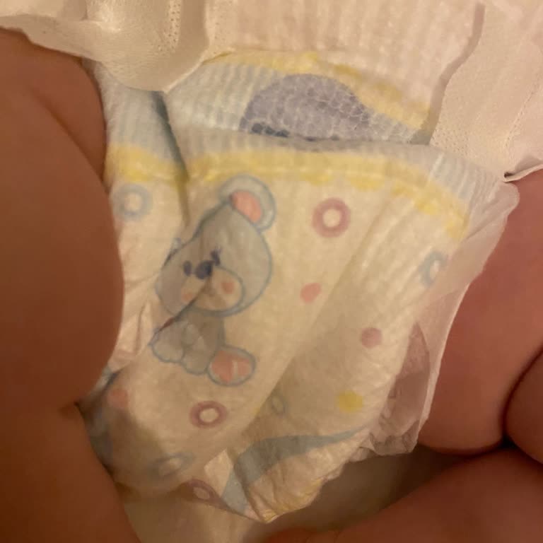 Molfix 2 Numara Islak Göstergesi Yok Hiç Kullanışlı Değil