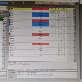 Ephesia Holiday Beach Club Bu Otelin Havuzları Hastalık Saçıyor