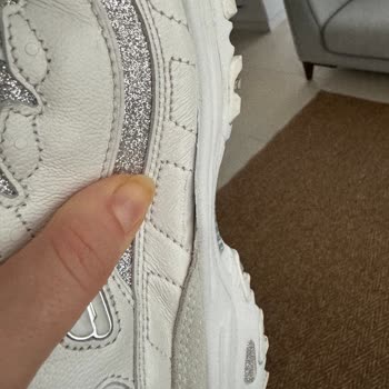 Skechers Sorunlu Ürününün Arkasında Durmuyor