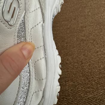 Skechers Sorunlu Ürününün Arkasında Durmuyor