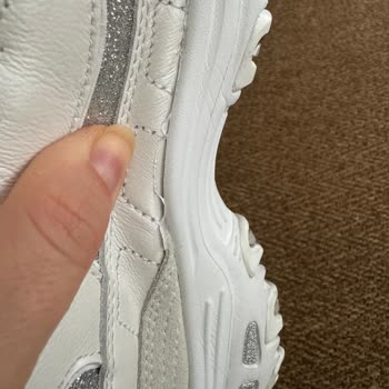Skechers Sorunlu Ürününün Arkasında Durmuyor