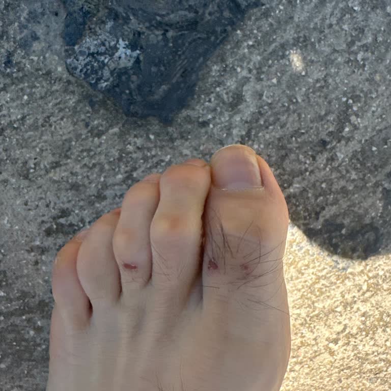 Özdilek Mağazasında Satılan Kalitesiz Terlikler Ayaklarımı Mahvetti