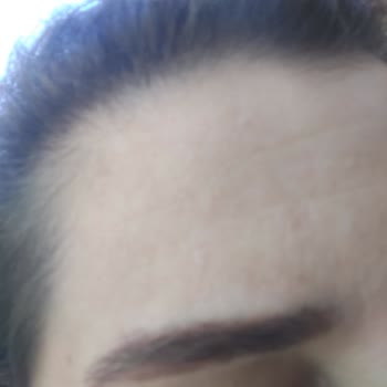 Elin Güzellik Güzellik Merkezindeki Olumsuz Deneyimim Ve Kalıcı Sorunlar