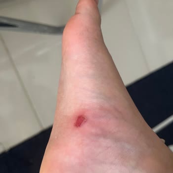 Igor Ayakkabı Kızımın Ayağını Mahveden 1300 Liralık Terlik!