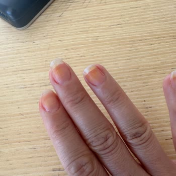 Flormar Tırnak Sarartan Oje