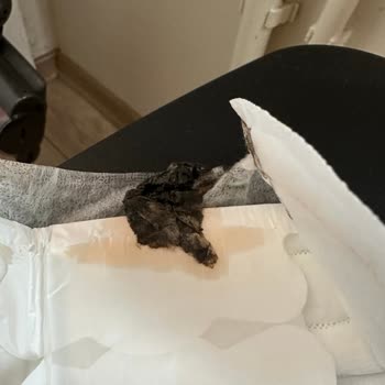 Molped Ürününde Beklenmedik Bir Durumla Karşılaştım