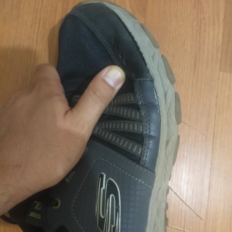 Мои кроссовки Skechers разваливаются в течение года