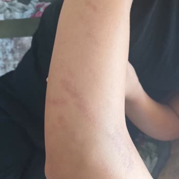 Sağlık Bakanlığı Güzellik Merkezinde Yaşanan Sorunlar