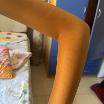 Sağlık Bakanlığı Güzellik Merkezinde Yaşanan Sorunlar