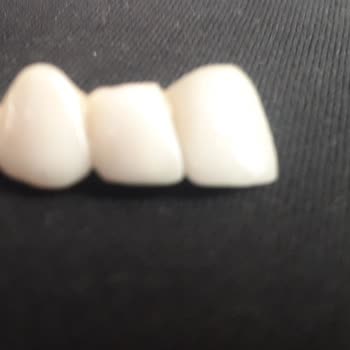 Tekirdağ Ağız Ve Diş Sağlığı Hastanesi Doktorun Yaptığı Hatalı İşlem!