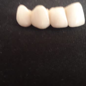 Tekirdağ Ağız Ve Diş Sağlığı Hastanesi Doktorun Yaptığı Hatalı İşlem!