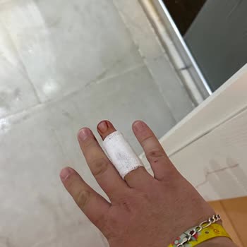 Tatilbudur Duş Kabini Patladı, Yaralandık Ve Otel Yetkilileri Bizi Ciddiye Almadı