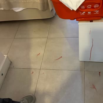 Tatilbudur Duş Kabini Patladı, Yaralandık Ve Otel Yetkilileri Bizi Ciddiye Almadı
