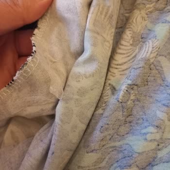 Suwen Pijama Kumaş Deformasyonu Ve Kullanıcı Hatası Diye Yanıtlanması