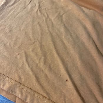 Çamaşır Makinesi Tüm Kıyafetlerimi Deliyor. Bosch Firması İlgilenmiyor