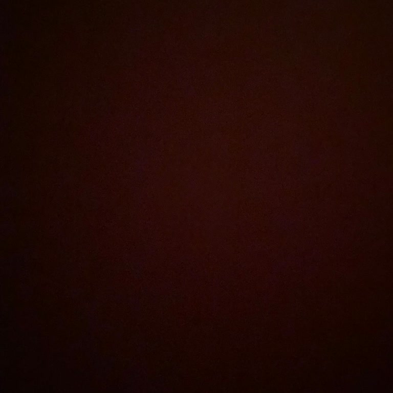 Nez Demir Epilasyon Şikayet 😡