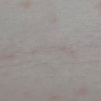Kiperin Collagen Peptides Yan Etkisi