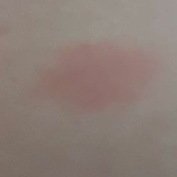 Kiperin Collagen Peptides Yan Etkisi