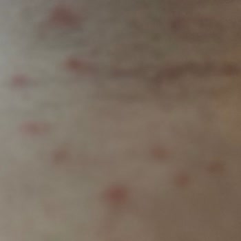 Kiperin Collagen Peptides Yan Etkisi