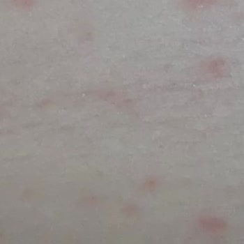 Kiperin Collagen Peptides Yan Etkisi