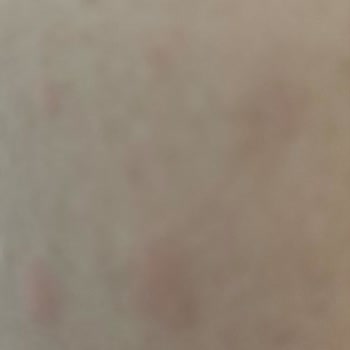 Kiperin Collagen Peptides Yan Etkisi