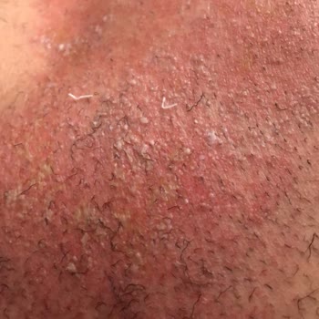 Agiss Gerekli Birimin İletişime Geçmesi Diliyorum