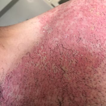 Agiss Gerekli Birimin İletişime Geçmesi Diliyorum