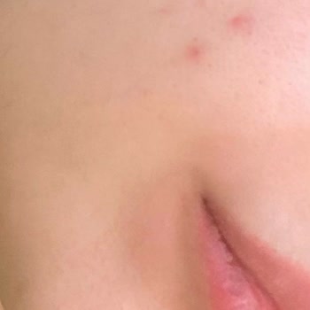 Loreal Paris L'Oreal Paris Bright Reveal SPF 50+ Sivilce Yapıyor!