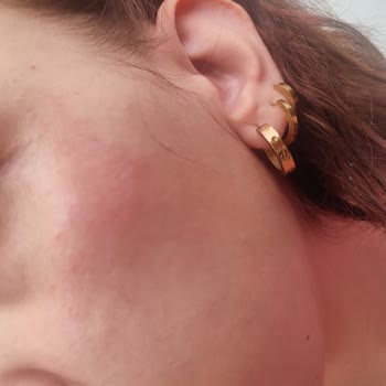 Facelab Gözenek Sıkılaştırıcı Serum Cildimi Tahriş Etti!