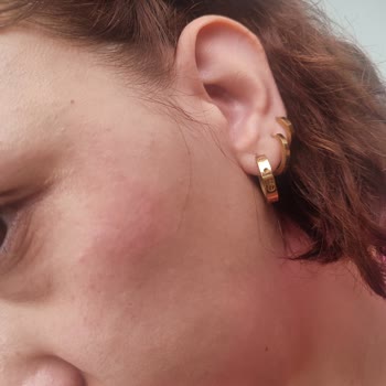 Facelab Gözenek Sıkılaştırıcı Serum Cildimi Tahriş Etti!