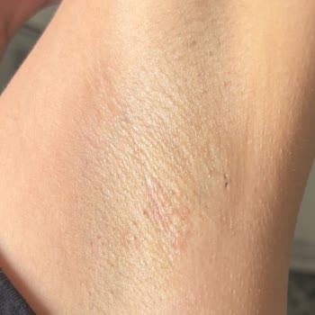 Bercislina Karşıyaka Şubesini Asla Tercih Etmemelisiniz