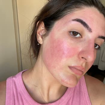 Watsons'ın Kendi Markası Miceller Su Cildimi Mahvetti!