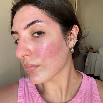 Watsons'ın Kendi Markası Miceller Su Cildimi Mahvetti!