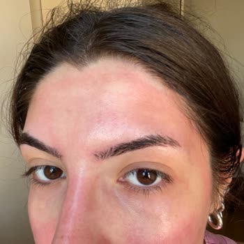 Watsons'ın Kendi Markası Miceller Su Cildimi Mahvetti!