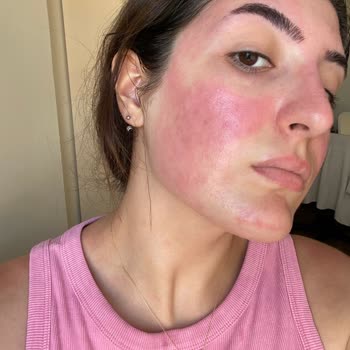 Watsons'ın Kendi Markası Miceller Su Cildimi Mahvetti!