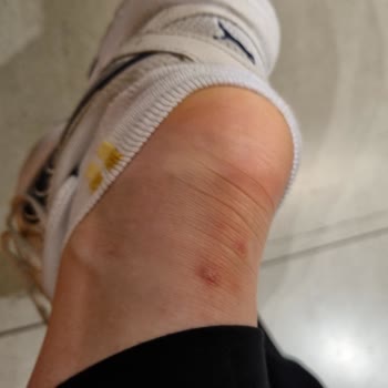 Nike Yeni Ayakkabı Ayağımı Mahvetti!